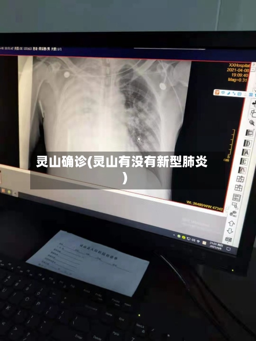 灵山确诊(灵山有没有新型肺炎)