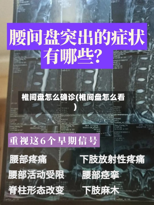 椎间盘怎么确诊(椎间盘怎么看)