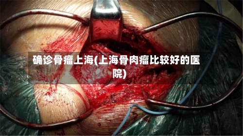 确诊骨瘤上海(上海骨肉瘤比较好的医院)