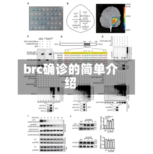 brc确诊的简单介绍-第2张图片