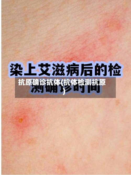 抗原确诊抗体(抗体检测抗原)-第2张图片