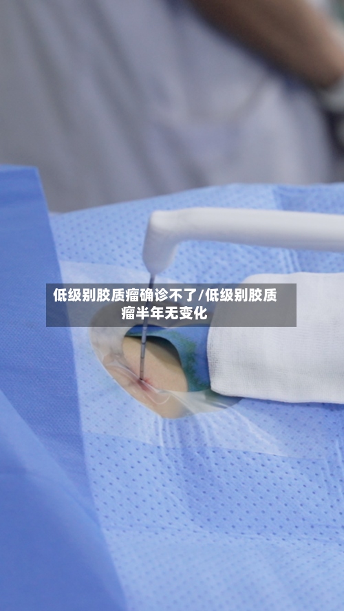 低级别胶质瘤确诊不了/低级别胶质瘤半年无变化-第2张图片