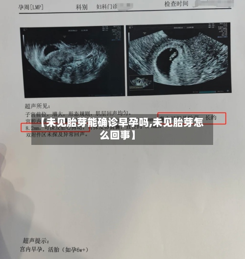 【未见胎芽能确诊早孕吗,未见胎芽怎么回事】