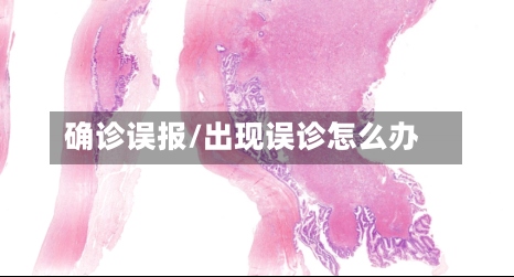 确诊误报/出现误诊怎么办-第3张图片