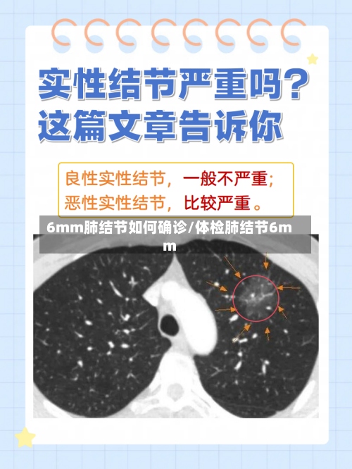6mm肺结节如何确诊/体检肺结节6mm