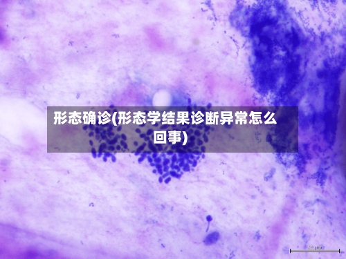 形态确诊(形态学结果诊断异常怎么回事)