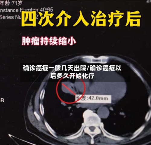 确诊癌症一般几天出院/确诊癌症以后多久开始化疗
