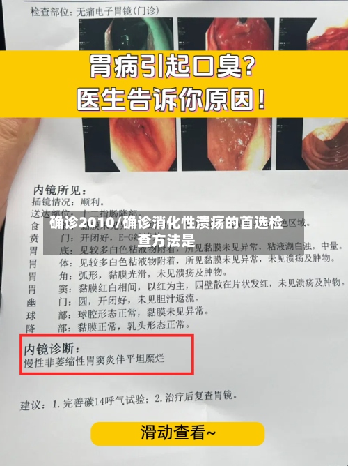确诊2010/确诊消化性溃疡的首选检查方法是-第2张图片
