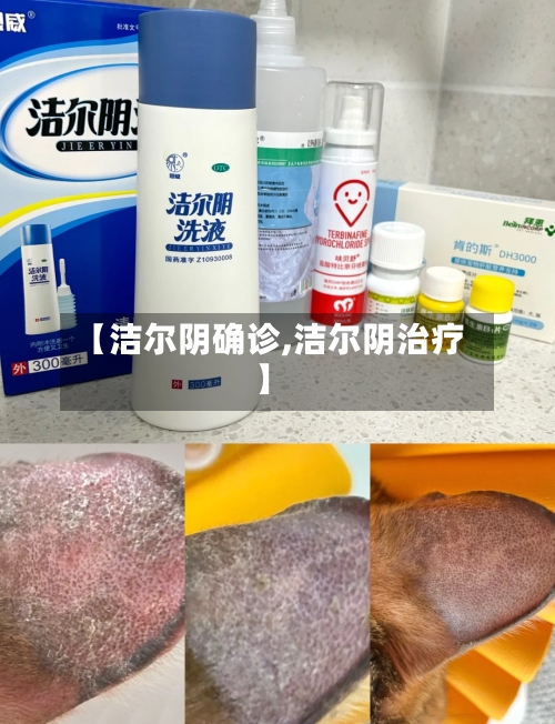 【洁尔阴确诊,洁尔阴治疗】-第3张图片