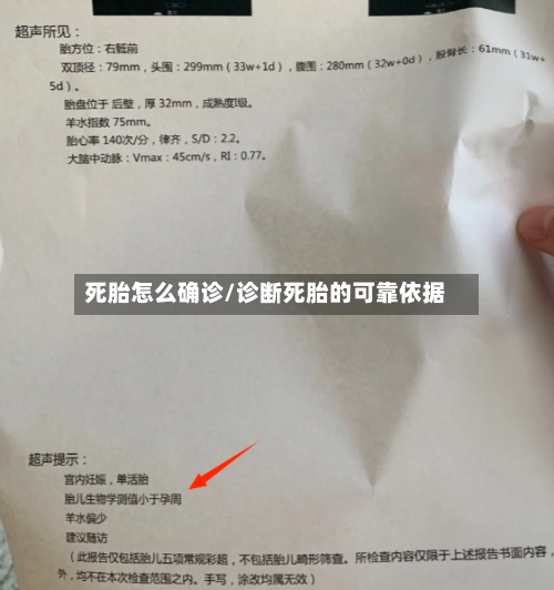 死胎怎么确诊/诊断死胎的可靠依据-第2张图片