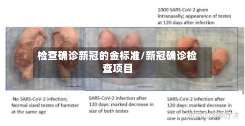 检查确诊新冠的金标准/新冠确诊检查项目