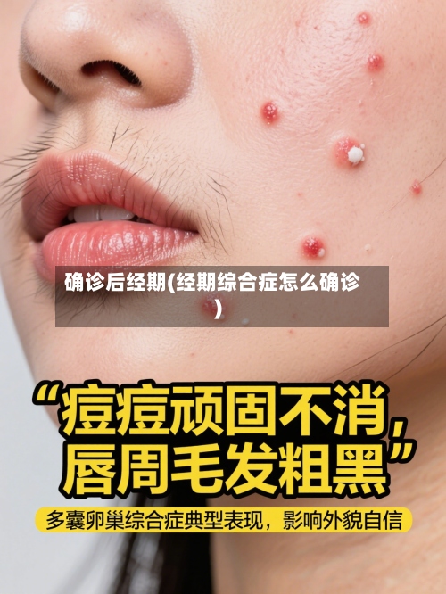 确诊后经期(经期综合症怎么确诊)-第2张图片