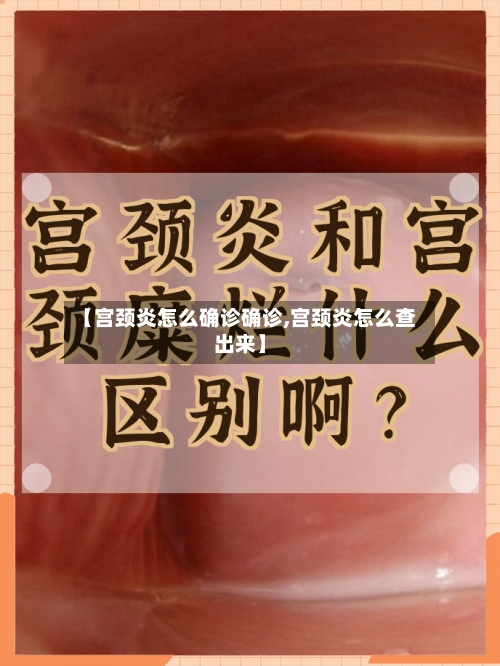 【宫颈炎怎么确诊确诊,宫颈炎怎么查出来】