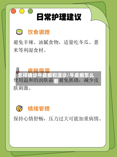 怎样确诊牛皮癣和湿诊/牛皮癣怎么看