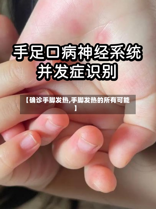 【确诊手脚发热,手脚发热的所有可能】-第2张图片