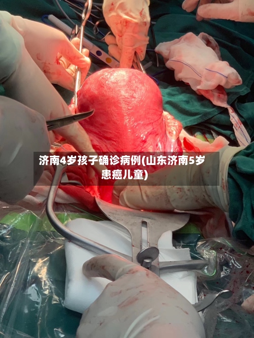 济南4岁孩子确诊病例(山东济南5岁患癌儿童)