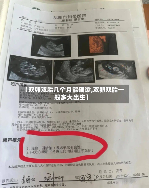【双卵双胎几个月能确诊,双卵双胎一般多大出生】-第2张图片
