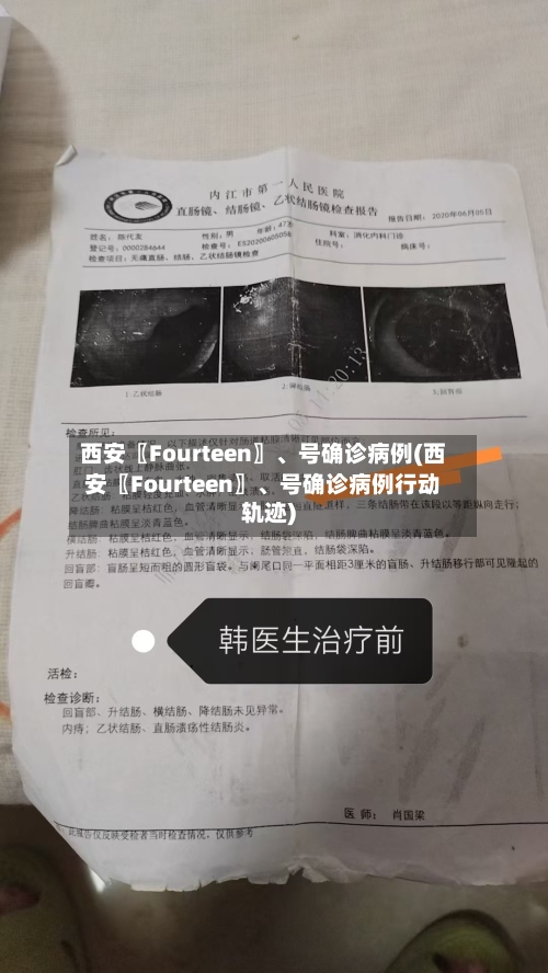 西安〖Fourteen〗、号确诊病例(西安〖Fourteen〗、号确诊病例行动轨迹)-第3张图片