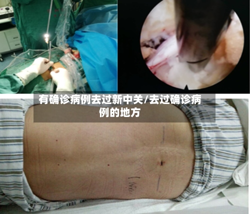 有确诊病例去过新中关/去过确诊病例的地方