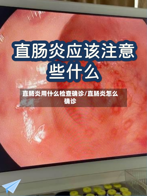 直肠炎用什么检查确诊/直肠炎怎么确诊-第3张图片