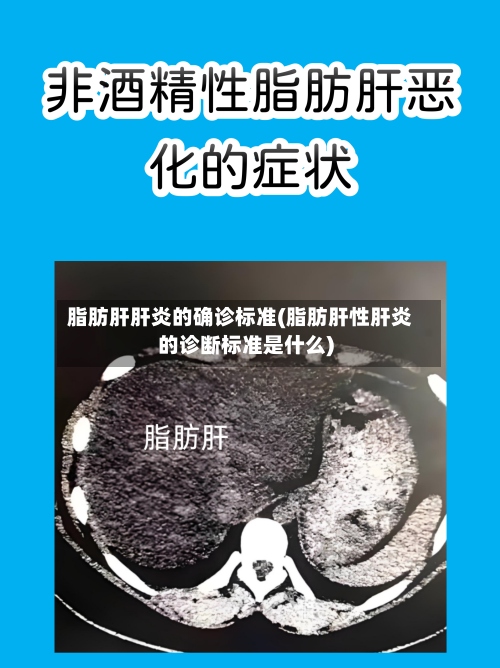 脂肪肝肝炎的确诊标准(脂肪肝性肝炎的诊断标准是什么)-第3张图片