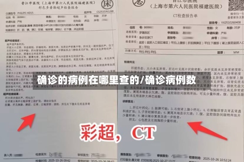 确诊的病例在哪里查的/确诊病例数-第3张图片