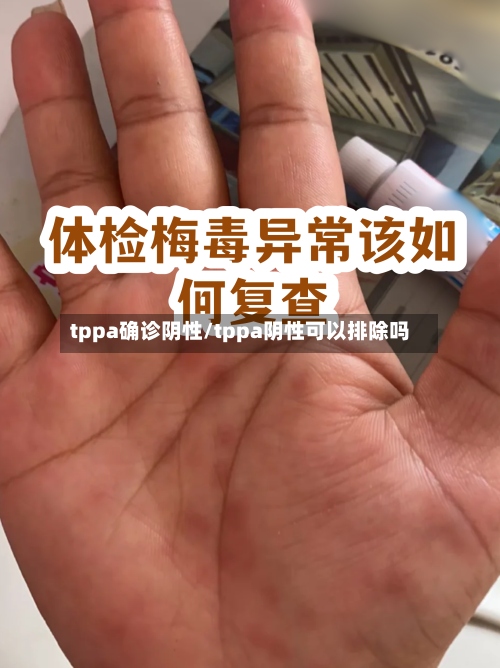 tppa确诊阴性/tppa阴性可以排除吗-第2张图片