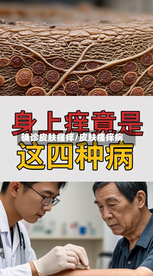 确诊皮肤瘙痒/皮肤瘙痒病