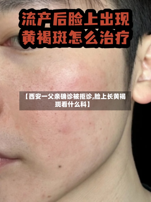【西安一父亲确诊被拒诊,脸上长黄褐斑看什么科】-第3张图片