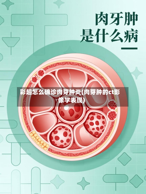 彩超怎么确诊肉芽肿炎(肉芽肿的ct影像学表现)